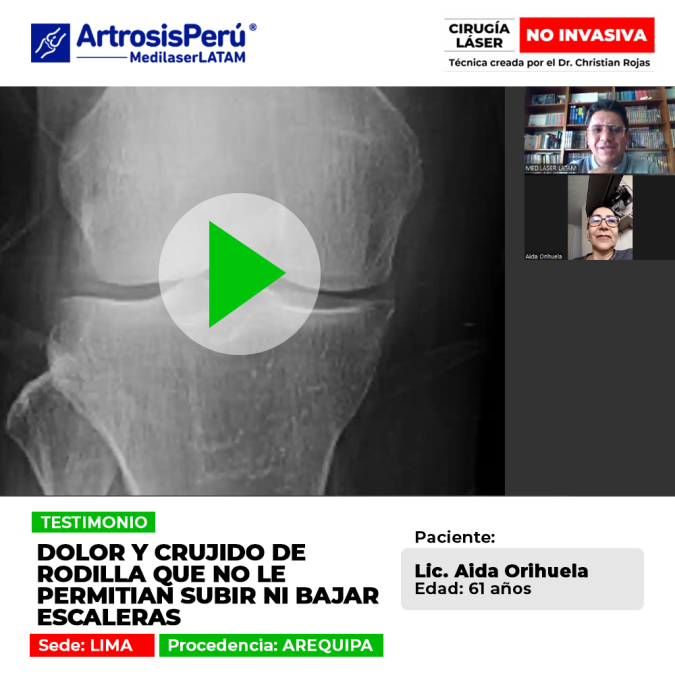 Una mirada al tratamiento tecnológico que ayudó a una licenciada a superar el desgaste articular y los molestos ruidos en sus rodillas.