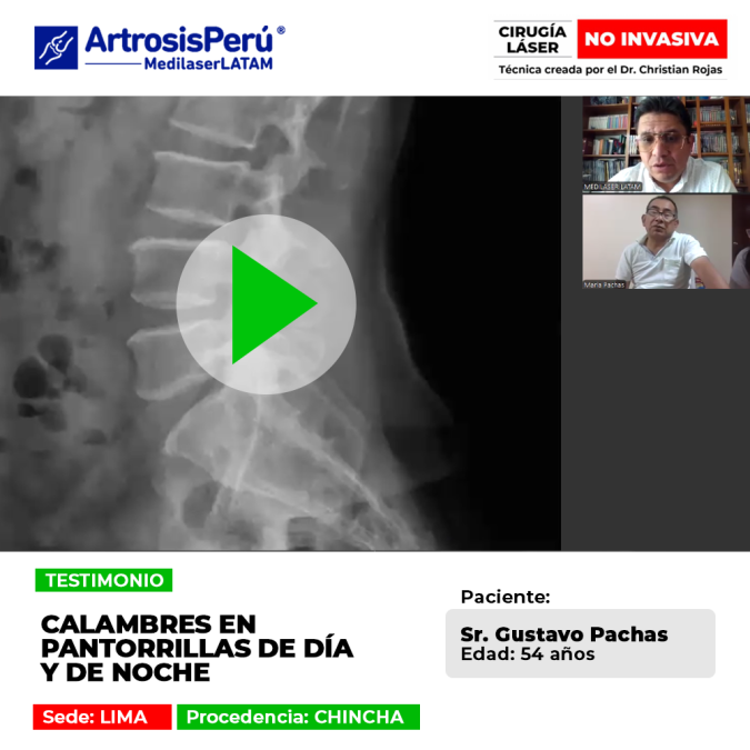 ¿Sufres de espasmos musculares continuos que interrumpen tu descanso? Conoce el testimonio de un paciente que superó los intensos calambres nocturnos y diurnos.