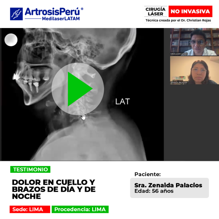 Conoce la historia de la paciente que alivió el dolor cervical persistente que afectaba su descanso las 24 horas.