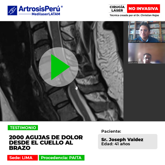 ¿Sientes hincadas como agujas en tus extremidades? Conoce el testimonio del paciente que superó este severo síntoma cervical.