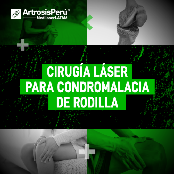 La condromalacia de rodilla desgasta el cartílago y causa un dolor persistente. Descubre cómo actúa la cirugía láser en tu articulación.