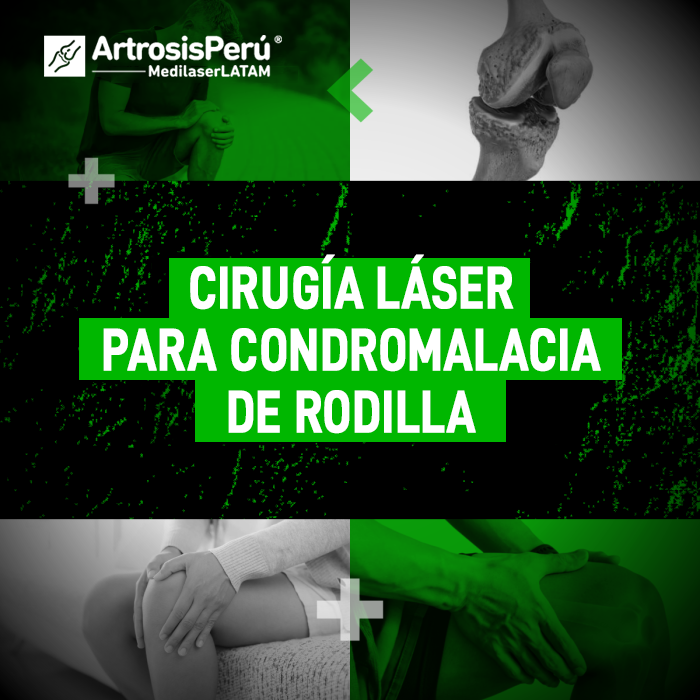 La condromalacia de rodilla desgasta el cartílago y causa un dolor persistente. Descubre cómo actúa la cirugía láser en tu articulación.