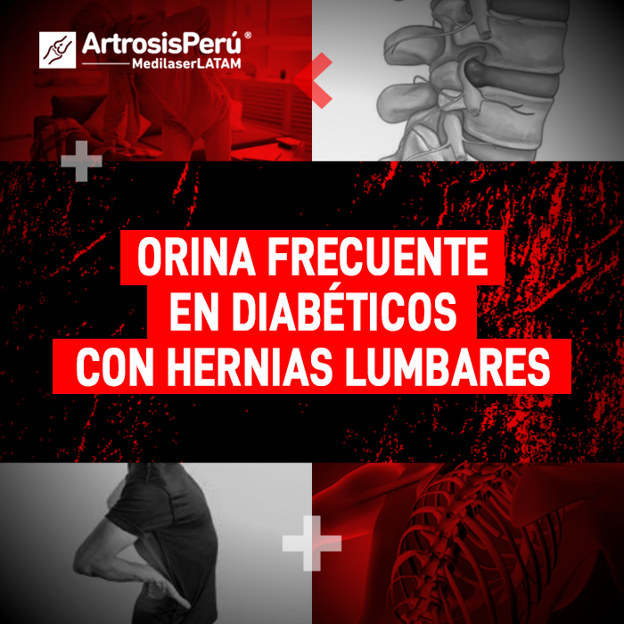 Infórmate sobre la relación entre la micción constante y la compresión nerviosa causada por las hernias lumbares en pacientes con diabetes.