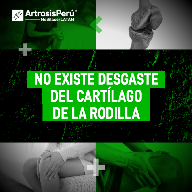 Descubre una perspectiva médica diferente sobre el dolor articular y lo que realmente sucede cuando te diagnostican desgaste del cartílago.