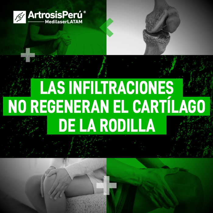 Las infiltraciones cartílago rodilla no reparan el desgaste articular. Infórmate sobre alternativas terapéuticas efectivas.