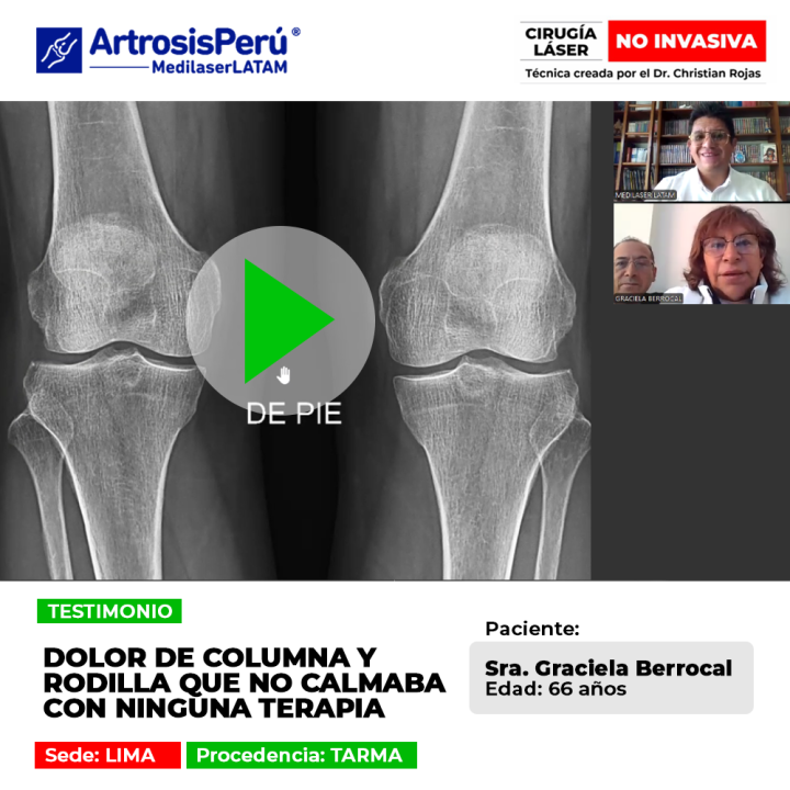 Conoce el testimonio de la paciente que superó un persistente dolor de columna y rodilla que no cedía ante los tratamientos convencionales.