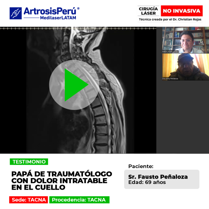 El dolor intratable en el cuello afectaba al papá de un traumatólogo en Tacna. Mira cómo logró superar su condición y aliviar su dolor.