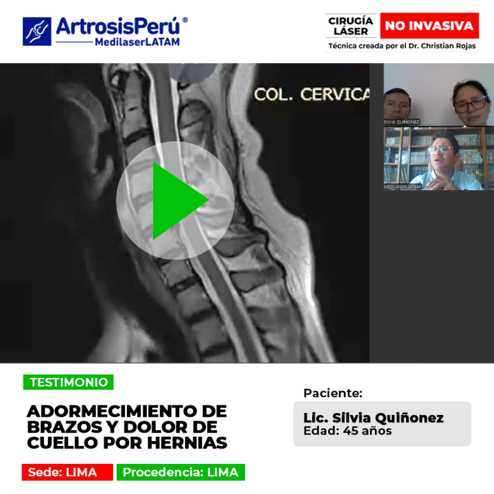 El adormecimiento de brazos y dolor cervical aquejaban a esta paciente en Lima. Descubre la solución médica que devolvió su salud.