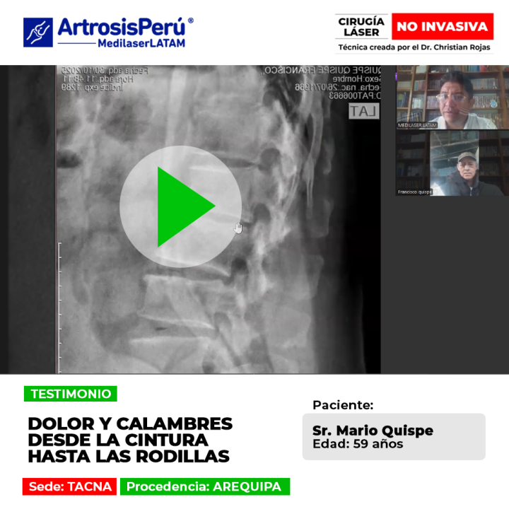El dolor y calambres continuos en las extremidades inferiores afectan gravemente la marcha. Descubre cómo lograr su alivio.