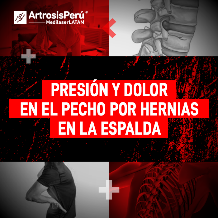 Las hernias en espalda pueden causar opresión torácica y malestar severo. Conoce la relación entre la columna y estos síntomas.