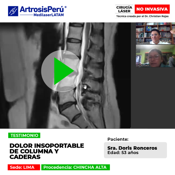 Un dolor de columna agudo en la zona lumbar afecta la estabilidad corporal. Consulta soluciones médicas para este padecimiento.