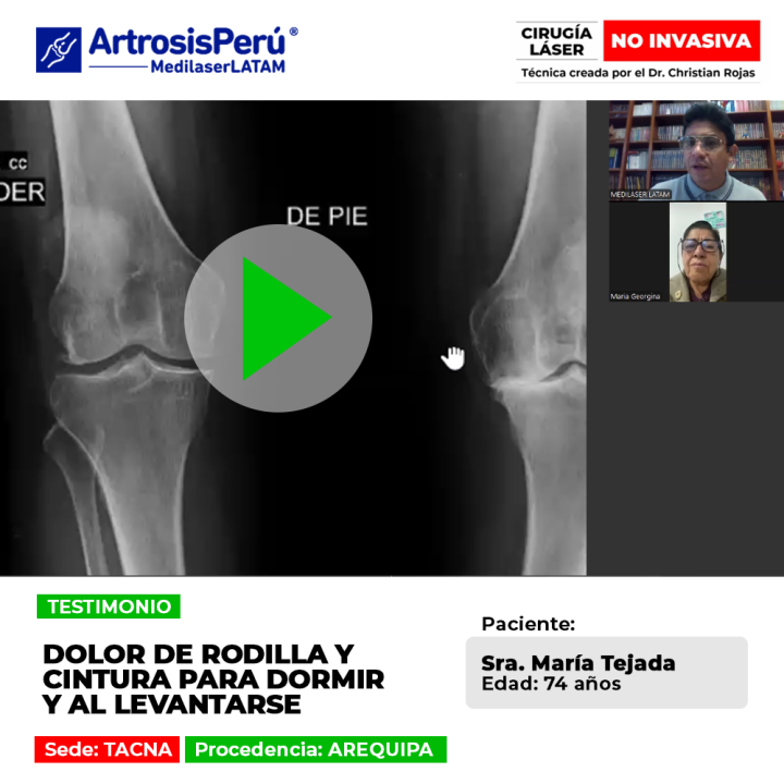 Dolor de rodilla y cintura al dormir: infórmate sobre sus causas principales y cómo tratar esta molestia al levantarse.