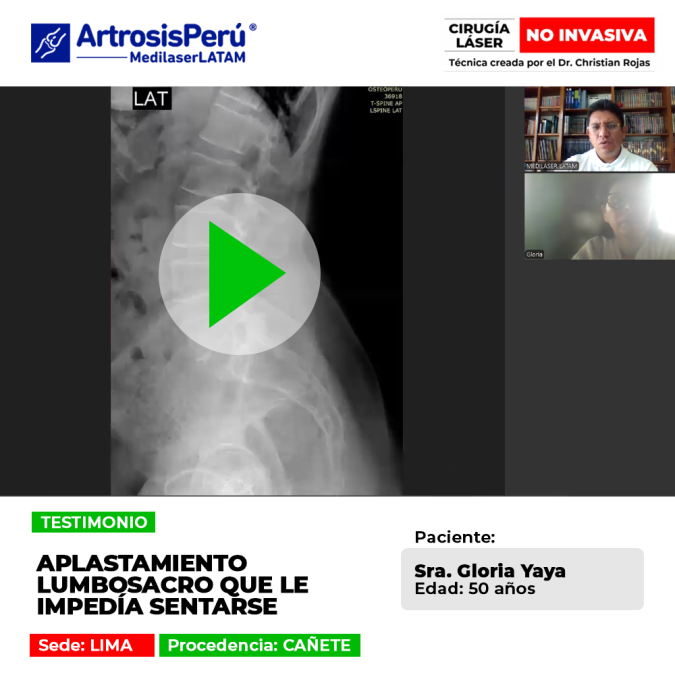 El aplastamiento lumbosacro causa dolores intensos e imposibilita sentarse. Conoce cómo recuperar la movilidad con este tratamiento.