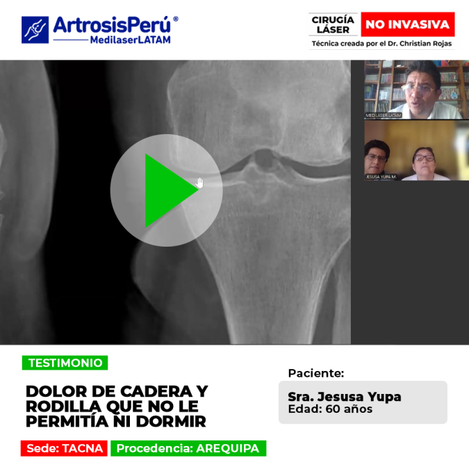 El dolor de cadera y articulaciones puede alterar el descanso nocturno. Descubre alternativas médicas para superar estas molestias.