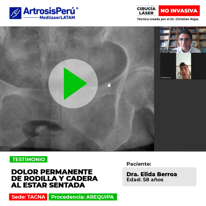 El dolor permanente rodilla y cadera dificulta permanecer en reposo. Infórmate sobre opciones efectivas para aliviar los síntomas.