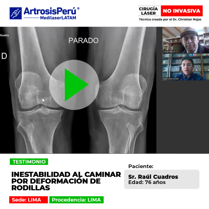 La deformación de rodillas produce inestabilidad y dificultad al andar. Conoce cómo recuperar la firmeza y calidad de movimiento.