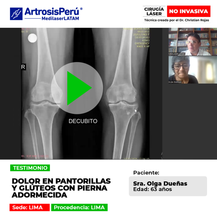 El dolor en pantorrillas y glúteos suele vincularse a compresión nerviosa lumbar. Conoce cómo aliviar el adormecimiento continuo.