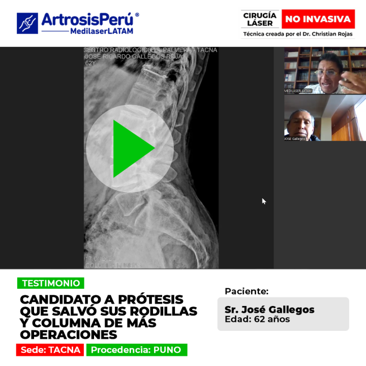 La prótesis de rodilla puede evitarse mediante tratamientos médicos avanzados. Descubre cómo proteger la columna y articulaciones.