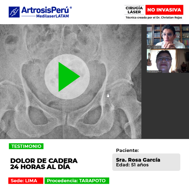 El dolor de cadera continuo desgasta la calidad de vida y el bienestar. Infórmate sobre alternativas terapéuticas para su control.