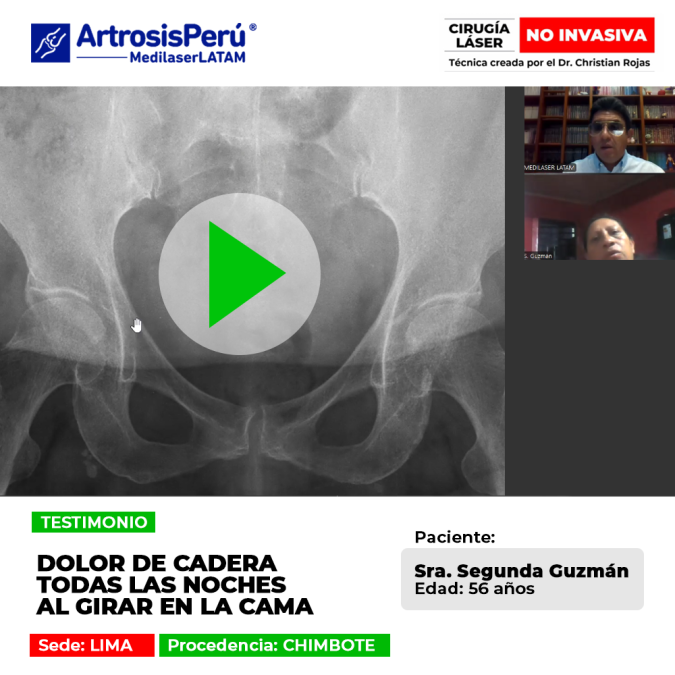 El dolor de cadera nocturno interrumpe el descanso y la movilidad en cama. Descubre procedimientos médicos para lograr mejoría.