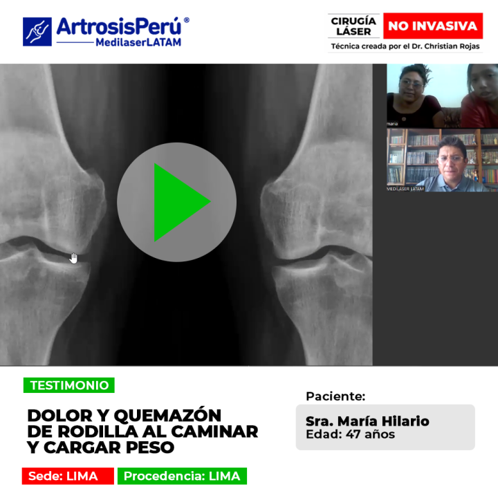 La quemazón de rodilla al caminar o levantar peso indica daño articular. Conoce las opciones médicas para recuperar la fuerza.