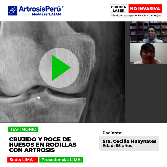 El crujido de rodillas y roce óseo advierten artrosis avanzada. Descubre tratamientos médicos para frenar el desgaste articular.