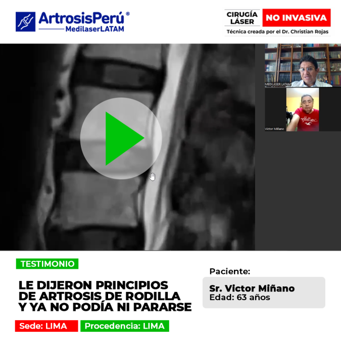 La artrosis de rodilla en fases avanzadas imposibilita ponerse de pie. Infórmate sobre soluciones oportunas para recuperar la marcha.