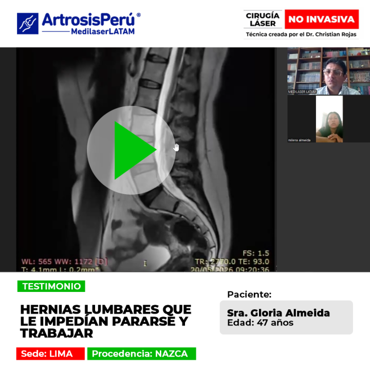 Las hernias lumbares severas llegan a impedir ponerse de pie o trabajar con normalidad. Infórmate sobre soluciones especializadas.