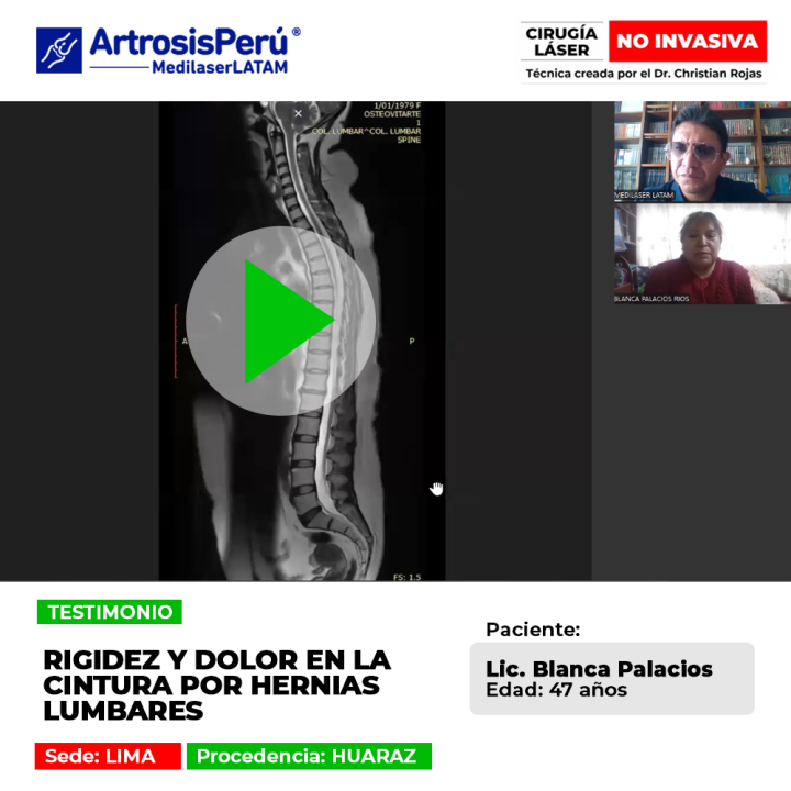 Las hernias lumbares provocan rigidez articular y dolor agudo en la cintura. Infórmate sobre procedimientos médicos para lograr alivio.