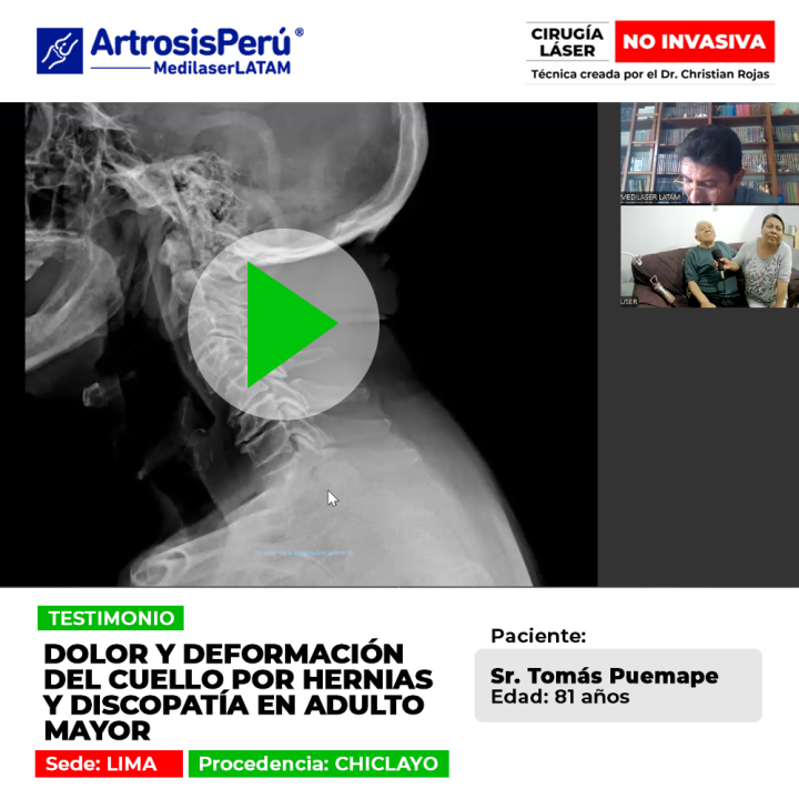 Las hernias y discopatía en la zona cervical generan dolor y rigidez en adultos mayores. Conoce opciones médicas para su recuperación.