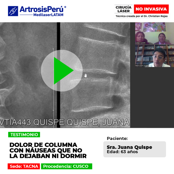 El dolor de columna severo puede generar náuseas y perturbar el sueño nocturno. Descubre soluciones médicas efectivas para descansar bien.