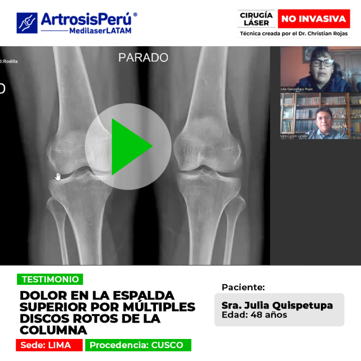 Los discos rotos columna causan intensas molestias en la espalda superior. Infórmate sobre alternativas médicas para aliviar los síntomas.