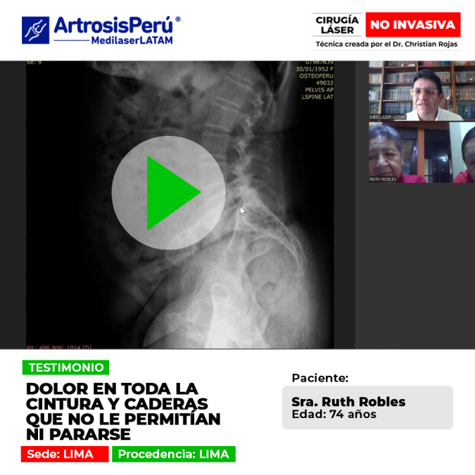 El dolor de cintura y cadera severo impide mantenerse de pie con normalidad. Conoce alternativas médicas para recuperar la movilidad.