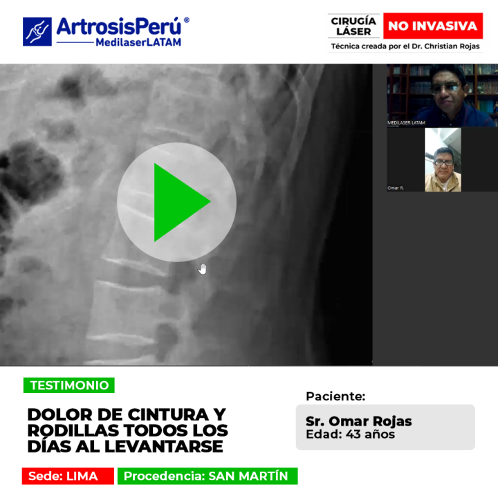 El dolor de cintura y rodillas al despertar afecta el inicio de la rutina diaria. Infórmate sobre opciones para aliviar las molestias.
