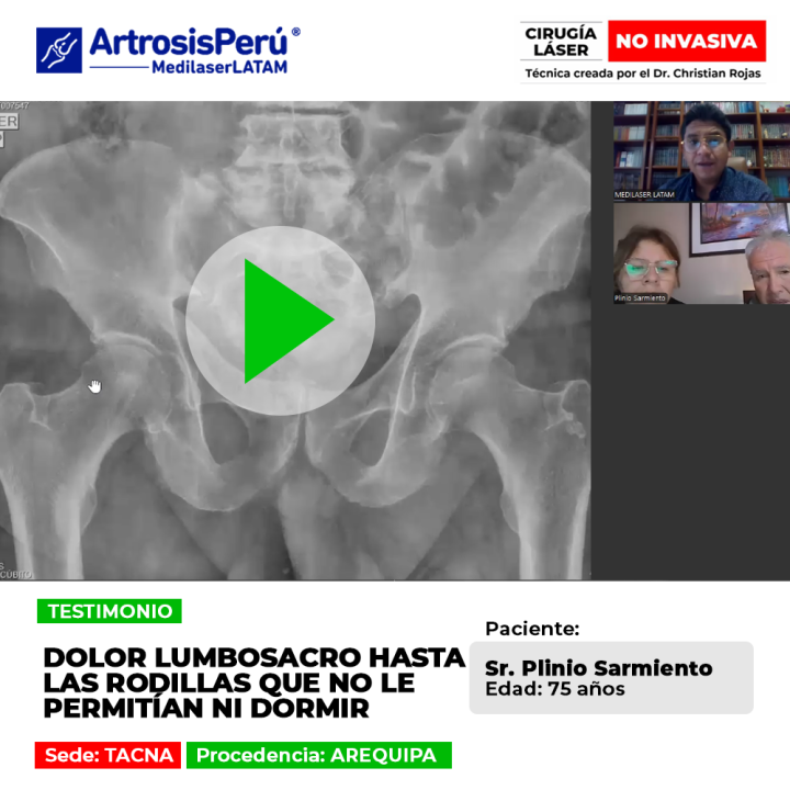El dolor lumbosacro irradiado a las piernas perjudica el descanso nocturno. Conoce cómo tratar esta molestia y volver a dormir bien.