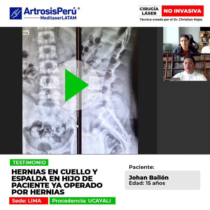 Las hernias en cuello y espalda afectan a jóvenes y adultos. Descubre cómo tratar los discos dañados y evitar operaciones complejas.