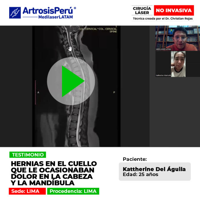 Las hernias en cuello provocan dolores irradiados hacia la cabeza y la mandíbula. Conoce soluciones médicas para calmar el malestar.