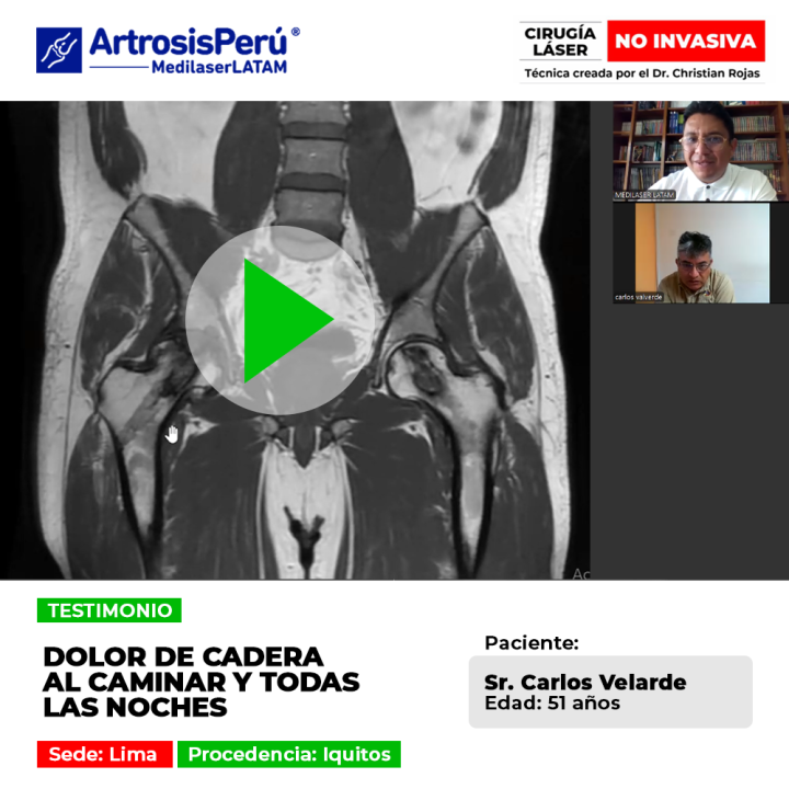 El dolor de cadera constante perjudica el andar y arruina el descanso nocturno. Conoce tratamientos especializados para superarlo.