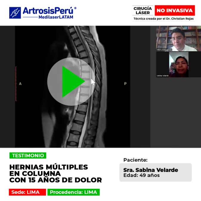 Las hernias múltiples en la columna vertebral generan dolores crónicos de larga duración. Infórmate sobre alternativas de mejoría.