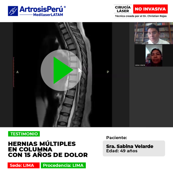 Las hernias múltiples en la columna vertebral generan dolores crónicos de larga duración. Infórmate sobre alternativas de mejoría.