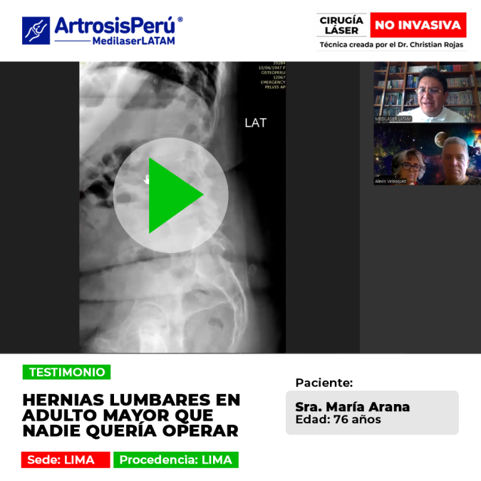 Las hernias lumbares en adultos mayores pueden tratarse sin cirugías riesgosas. Conoce alternativas médicas seguras para su bienestar.